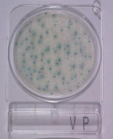 compact_dry_vp_vibrio_parahaemolyticus_teszt.jpg
