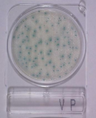 compact_dry_vp_vibrio_parahaemolyticus_teszt.jpg